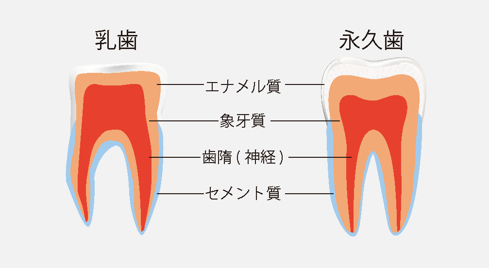 永久歯の変形・変色