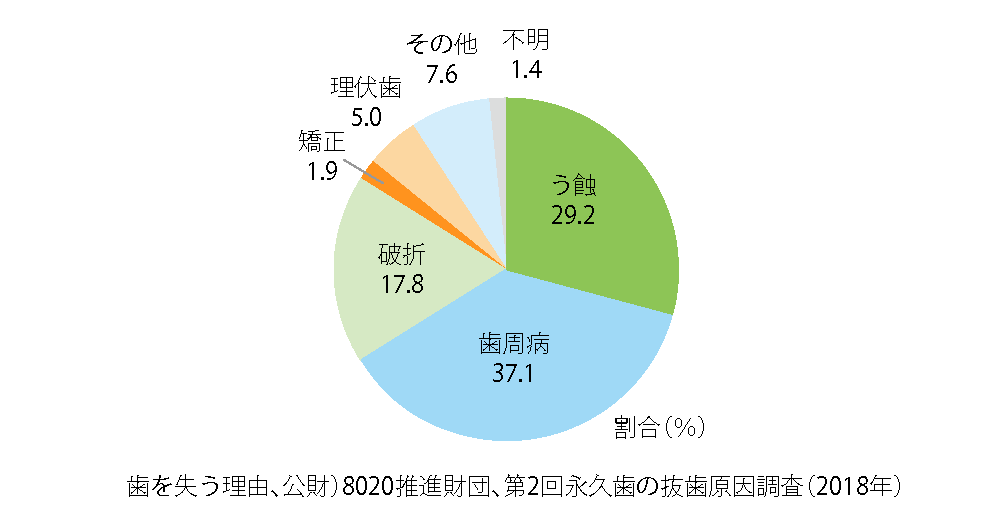 歯を失う主な原因のひとつ