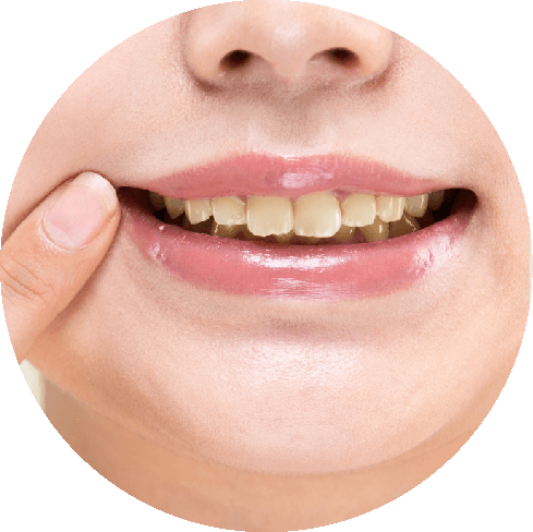 永久歯に起こる問題